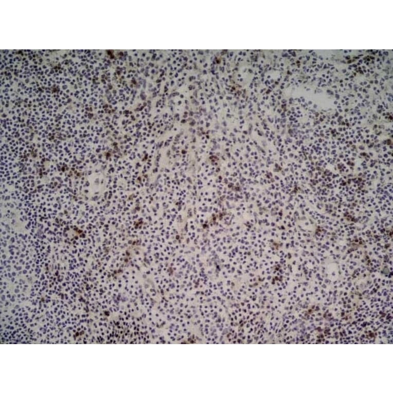 Immunohistochemistry - Anti-NKG2D Antibody [1D11] (A279090) - Antibodies.com