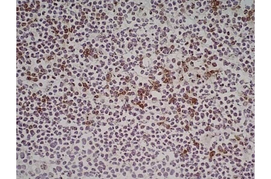 Immunohistochemistry - Anti-NKG2D Antibody [1D11] (A279090) - Antibodies.com