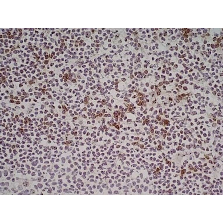 Immunohistochemistry - Anti-NKG2D Antibody [1D11] (A279090) - Antibodies.com