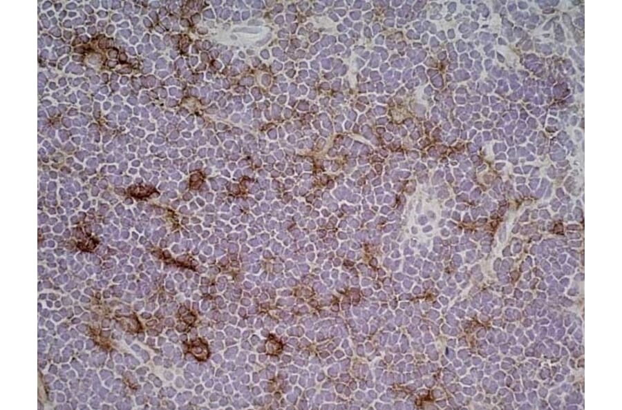 Immunohistochemistry - Anti-CD86 Antibody [24F] (A279144) - Antibodies.com