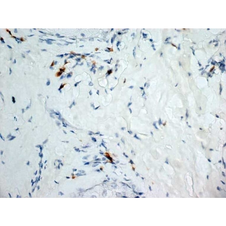 Immunohistochemistry - Anti-Dectin-1 Antibody [2A11] (A279170) - Antibodies.com