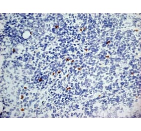 Immunohistochemistry - Anti-Dectin-1 Antibody [2A11] (A279170) - Antibodies.com