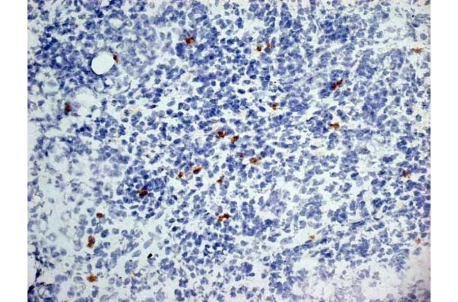 Immunohistochemistry - Anti-Dectin-1 Antibody [2A11] (A279170) - Antibodies.com