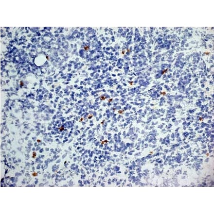 Immunohistochemistry - Anti-Dectin-1 Antibody [2A11] (A279170) - Antibodies.com