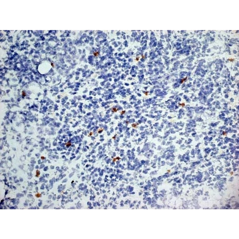 Immunohistochemistry - Anti-Dectin-1 Antibody [2A11] (A279170) - Antibodies.com