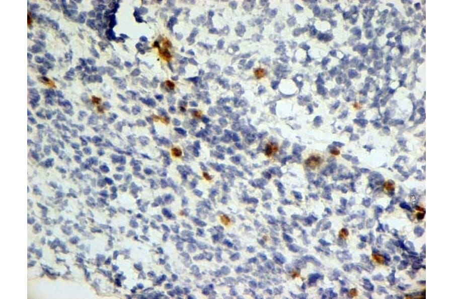 Immunohistochemistry - Anti-Dectin-1 Antibody [2A11] (A279170) - Antibodies.com