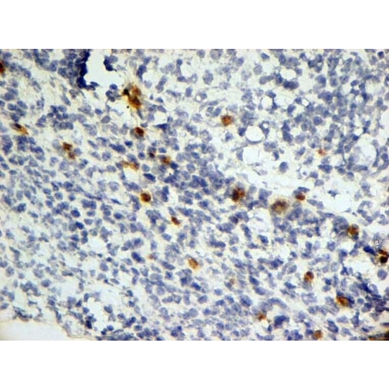 Immunohistochemistry - Anti-Dectin-1 Antibody [2A11] (A279170) - Antibodies.com