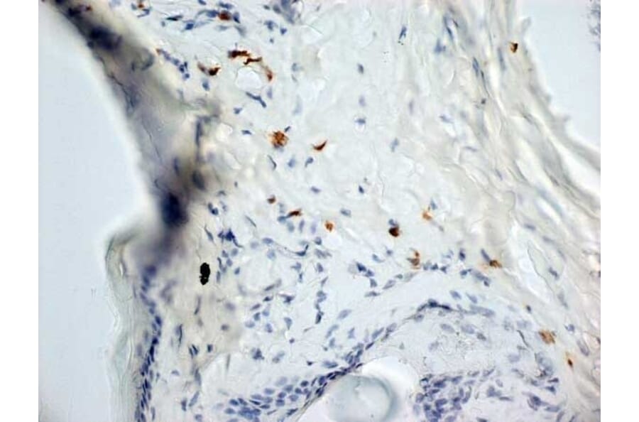 Immunohistochemistry - Anti-Dectin-1 Antibody [2A11] (A279170) - Antibodies.com