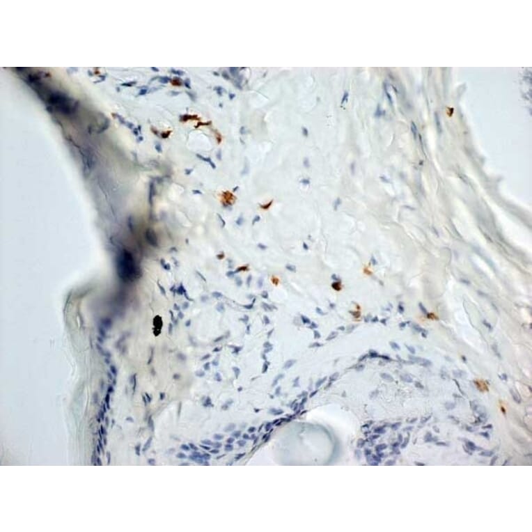 Immunohistochemistry - Anti-Dectin-1 Antibody [2A11] (A279170) - Antibodies.com