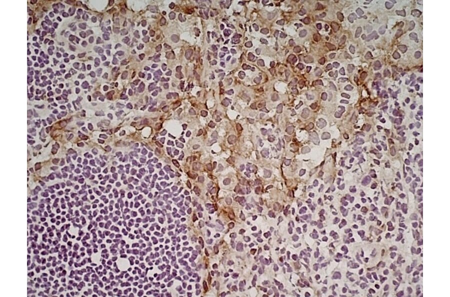 Immunohistochemistry - Anti-CD204 Antibody [2F8] (A279222) - Antibodies.com