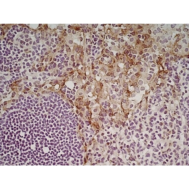 Immunohistochemistry - Anti-CD204 Antibody [2F8] (A279222) - Antibodies.com