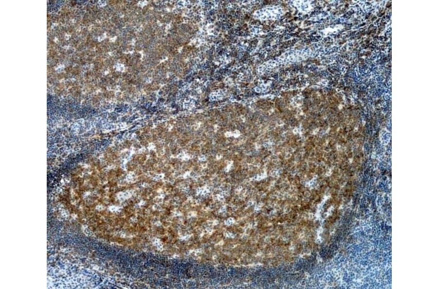 Immunohistochemistry - Anti-CD20 Antibody [2H7] (A279242) - Antibodies.com