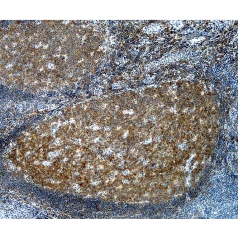 Immunohistochemistry - Anti-CD20 Antibody [2H7] (A279242) - Antibodies.com