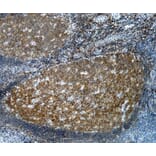 Immunohistochemistry - Anti-CD20 Antibody [2H7] (A279242) - Antibodies.com