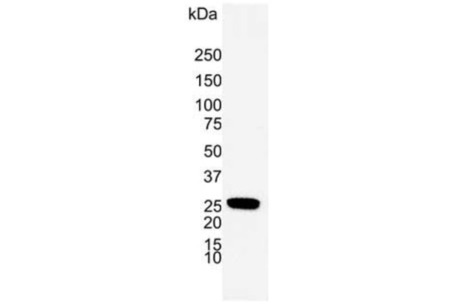 Western Blot - Anti-PGP9.5 Antibody [31A3] (A279256) - Antibodies.com