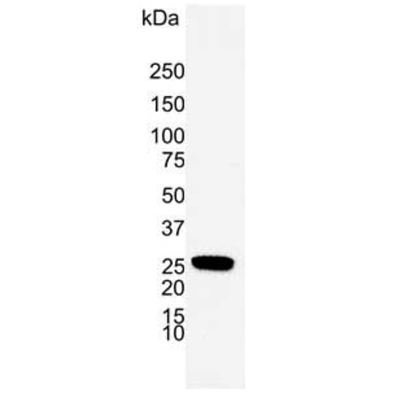 Western Blot - Anti-PGP9.5 Antibody [31A3] (A279256) - Antibodies.com