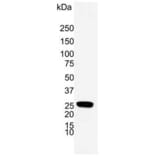 Western Blot - Anti-PGP9.5 Antibody [31A3] (A279256) - Antibodies.com