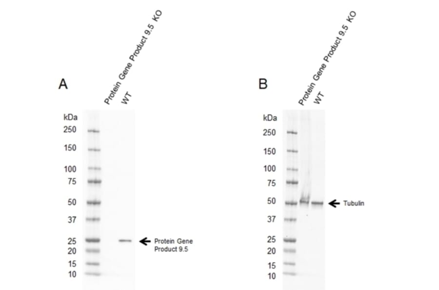 Western Blot - Anti-PGP9.5 Antibody [31A3] (A279256) - Antibodies.com
