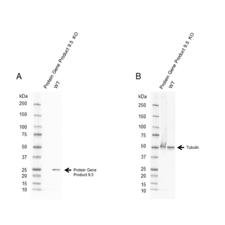 Western Blot - Anti-PGP9.5 Antibody [31A3] (A279256) - Antibodies.com