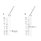 Western Blot - Anti-PGP9.5 Antibody [31A3] (A279256) - Antibodies.com