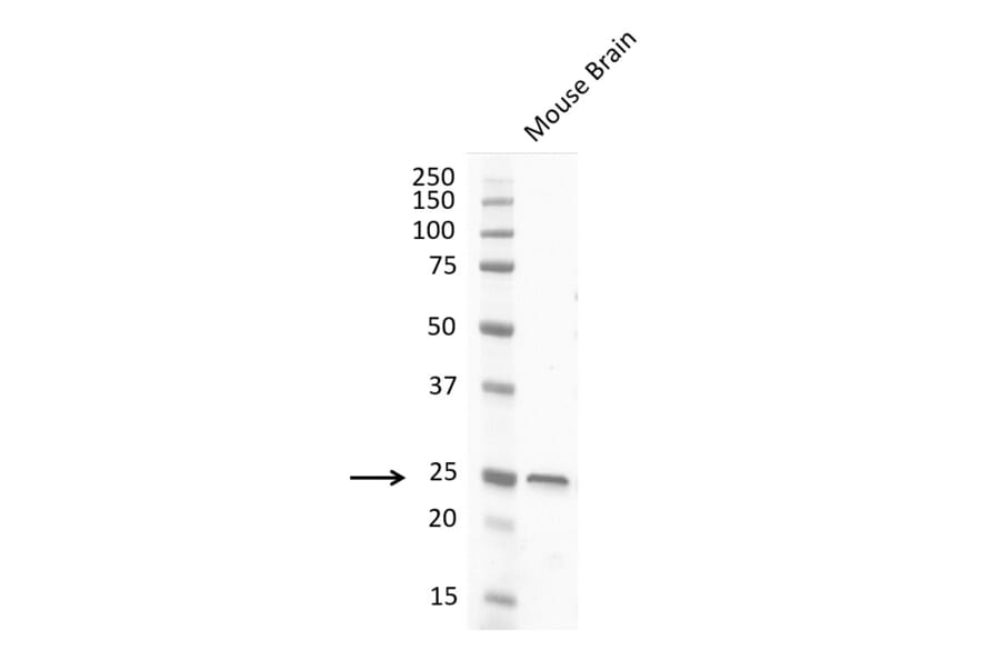 Western Blot - Anti-PGP9.5 Antibody [31A3] (A279256) - Antibodies.com
