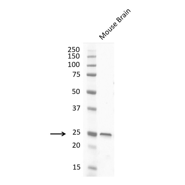 Western Blot - Anti-PGP9.5 Antibody [31A3] (A279256) - Antibodies.com