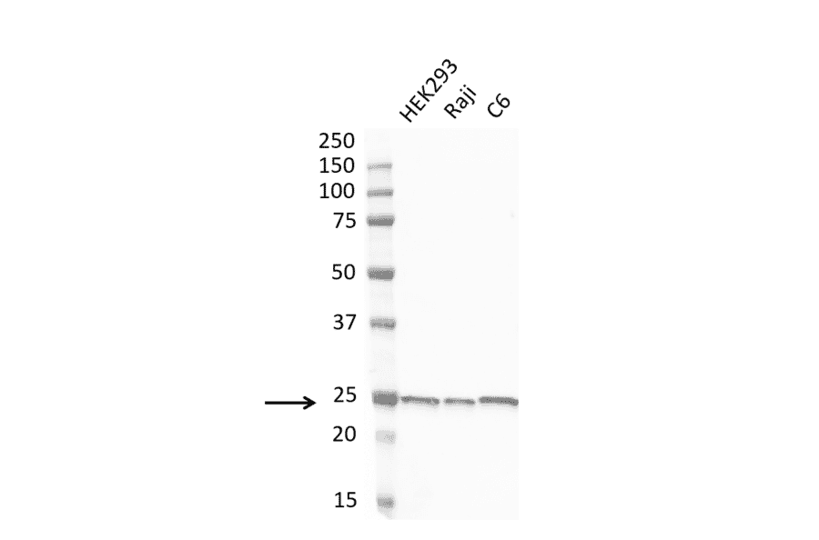 Western Blot - Anti-PGP9.5 Antibody [31A3] (A279256) - Antibodies.com