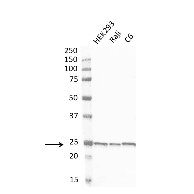 Western Blot - Anti-PGP9.5 Antibody [31A3] (A279256) - Antibodies.com
