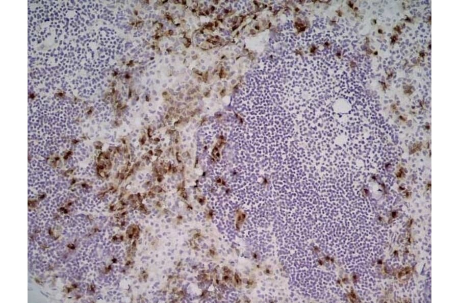 Immunohistochemistry - Anti-Sialoadhesin / CD169 Antibody [3D6.112] (A279297) - Antibodies.com
