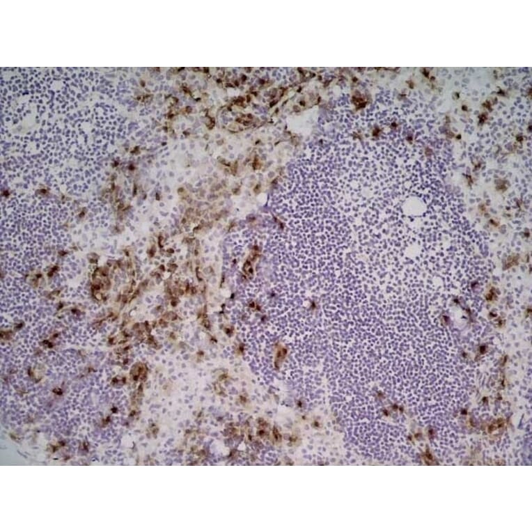 Immunohistochemistry - Anti-Sialoadhesin / CD169 Antibody [3D6.112] (A279297) - Antibodies.com
