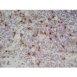 Immunohistochemistry - Anti-Sialoadhesin / CD169 Antibody [3D6.112] (A279297) - Antibodies.com