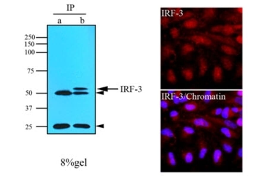 Immunoprecipitation  - Anti-IRF3 Antibody [3F10] (A279303) - Antibodies.com