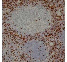 Immunohistochemistry - Anti-CD8 Antibody [4B11] (A279342) - Antibodies.com