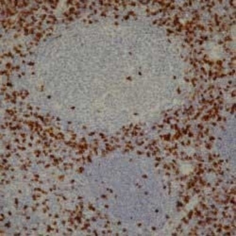 Immunohistochemistry - Anti-CD8 Antibody [4B11] (A279342) - Antibodies.com