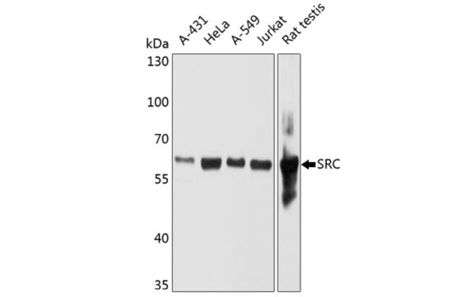 Western Blot - Anti-Src Antibody [4F10B5] (A279376) - Antibodies.com