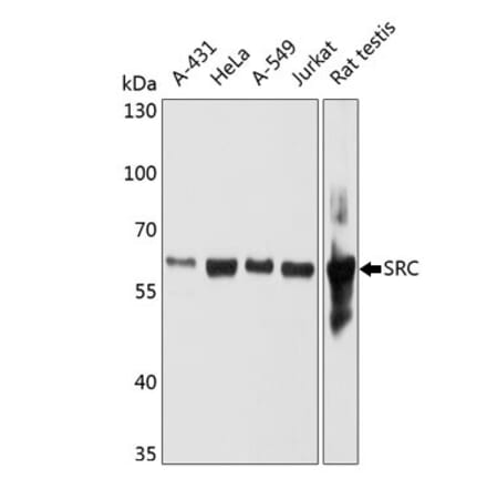 Western Blot - Anti-Src Antibody [4F10B5] (A279376) - Antibodies.com