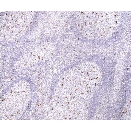 Immunohistochemistry - Anti-CD68 Antibody [514H12] (A279396) - Antibodies.com