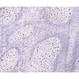 Immunohistochemistry - Anti-CD68 Antibody [514H12] (A279396) - Antibodies.com