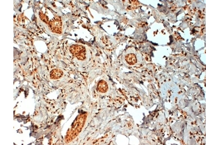 Immunohistochemistry - Anti-Estrogen Receptor beta 2 Antibody [57/3] (A279408) - Antibodies.com