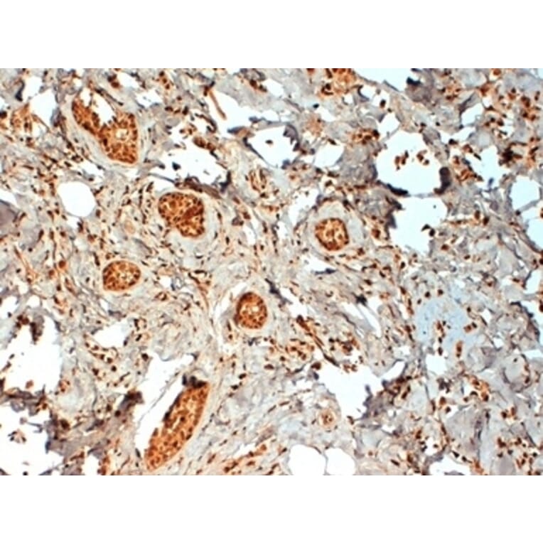 Immunohistochemistry - Anti-Estrogen Receptor beta 2 Antibody [57/3] (A279408) - Antibodies.com