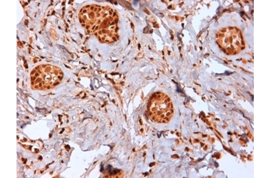 Immunohistochemistry - Anti-Estrogen Receptor beta 2 Antibody [57/3] (A279408) - Antibodies.com
