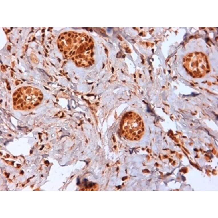 Immunohistochemistry - Anti-Estrogen Receptor beta 2 Antibody [57/3] (A279408) - Antibodies.com