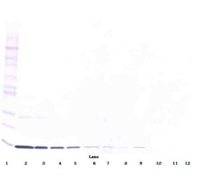 Western Blot - Anti-IL-3 Antibody [5A4-1-16] - BSA and Azide free (A279418) - Antibodies.com
