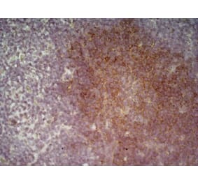 Immunohistochemistry - Anti-CD19 Antibody [6D5] (A279481) - Antibodies.com