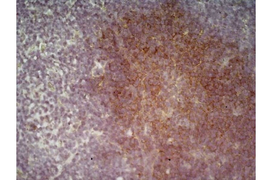 Immunohistochemistry - Anti-CD19 Antibody [6D5] (A279481) - Antibodies.com