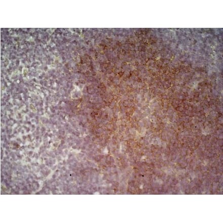 Immunohistochemistry - Anti-CD19 Antibody [6D5] (A279481) - Antibodies.com