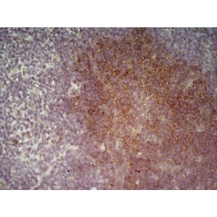 Immunohistochemistry - Anti-CD19 Antibody [6D5] (A279481) - Antibodies.com