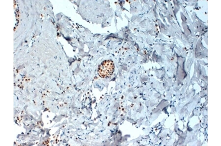 Immunohistochemistry - Anti-Estrogen Receptor alpha Antibody [6F11] (A279486) - Antibodies.com