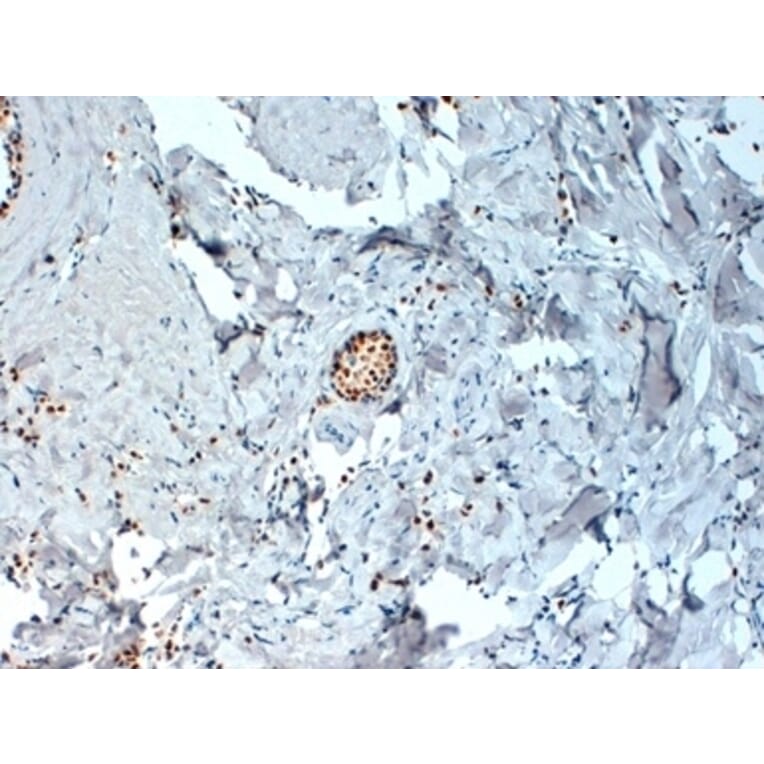 Immunohistochemistry - Anti-Estrogen Receptor alpha Antibody [6F11] (A279486) - Antibodies.com