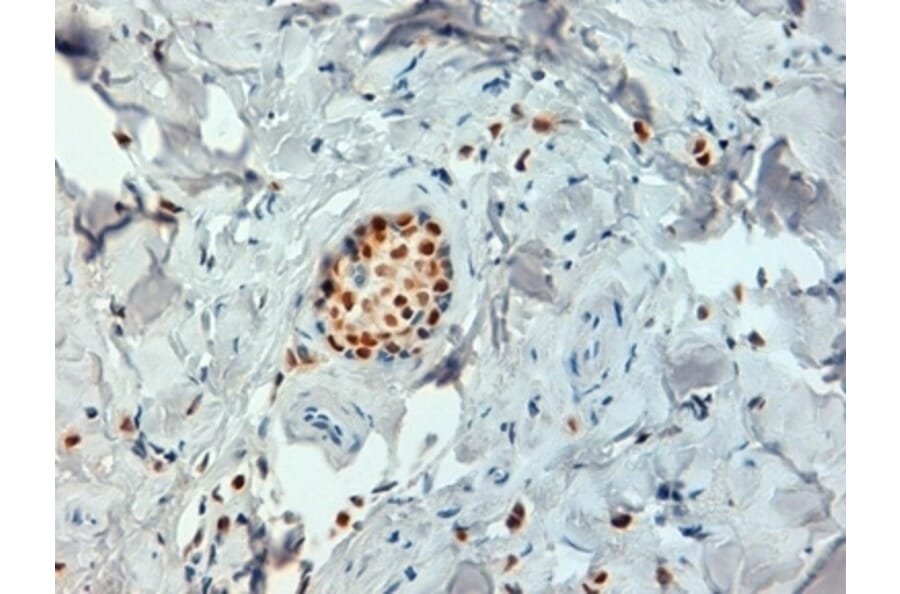 Immunohistochemistry - Anti-Estrogen Receptor alpha Antibody [6F11] (A279486) - Antibodies.com